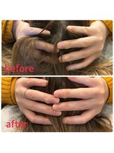 小林整骨院 本町/【頭皮のコリ撃退】