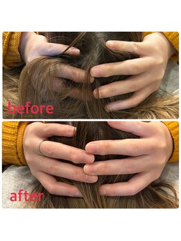 小林整骨院 本町/【頭皮のコリ撃退】