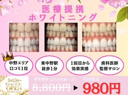 メルヴェイユの写真