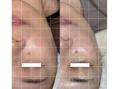 ミヨン(Miyong)の写真