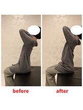 ナオル整体 福岡香椎院(NAORU整体)/４０代女性　施術事例【猫背】