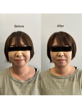 整体や呟熙/いつもご贔屓頂いてます。K様