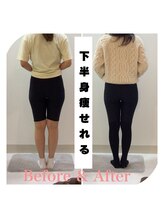 スタイルラボ高松/産後骨盤矯正の効果♪