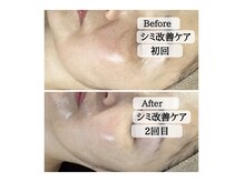 ル ボヌールの雰囲気（シミケア　目元のモヤモヤが目立たなく◎肌自体が美しく）