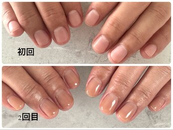 ビオナス(BioNas)/深爪育成