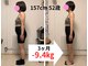 ナチュールフィット 宝塚店(Natur Fit)の写真/【結果重視!!】何をしても痩せなかった方に◎お客様に合わせた耳つぼ施術×食事指導で憧れの美ボディに☆