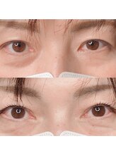 カルペディエム(Carpe diem)/