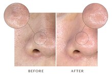 ユーフォリアファステ シルキー(Euphoria Faste Silky)