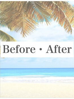 ハウオラ 恵比寿2(HAUOLA)/ビフォーアフター