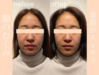 健志接骨院/BeforeAfter