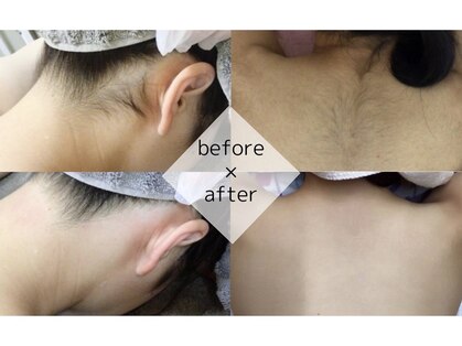 アルゴ 小倉守恒店(ALGO)の写真