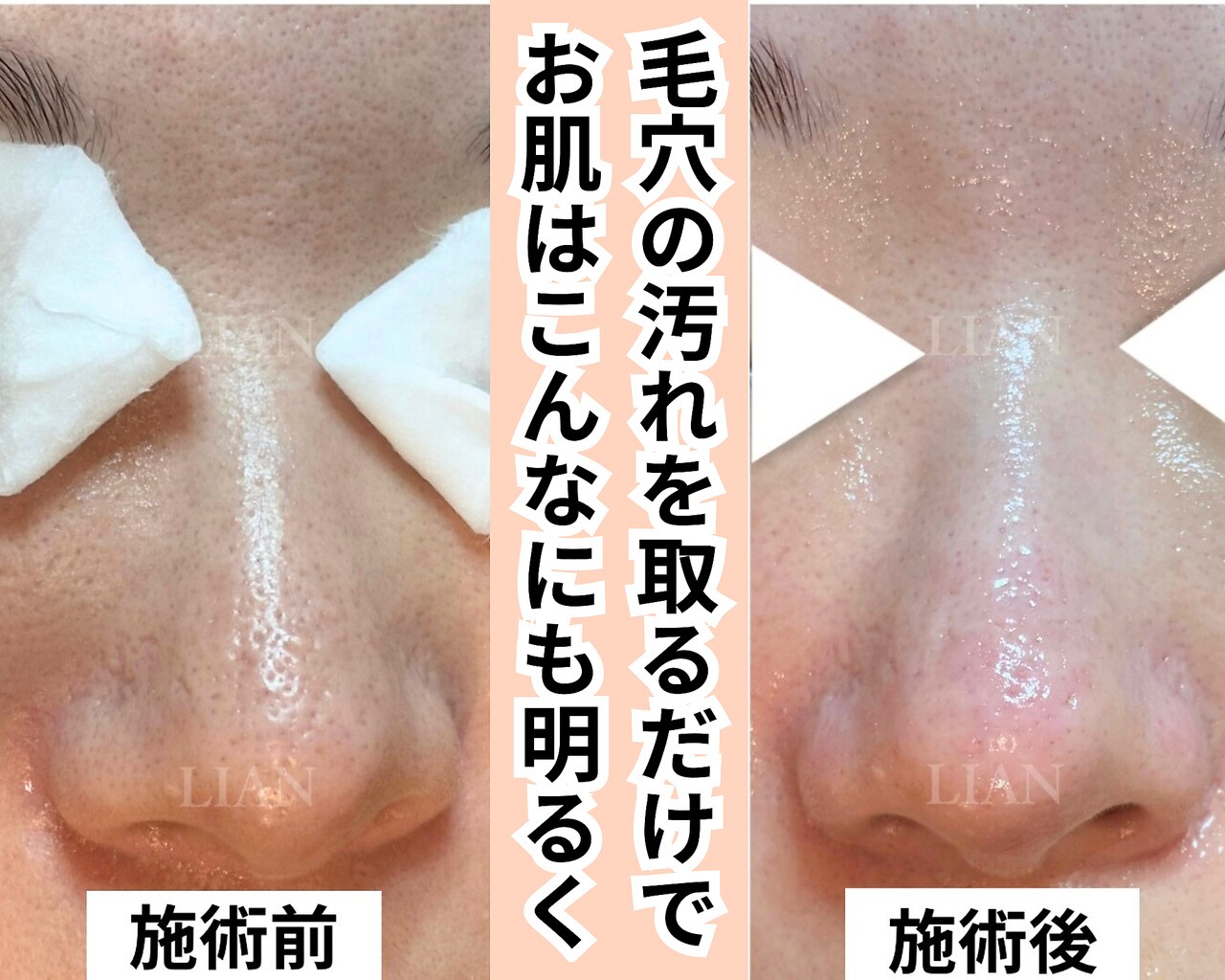 リアン(LIAN)｜ホットペッパービューティー