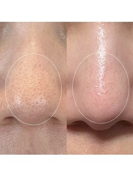 ソワ 吉塚店(soi)/何歳からでも変われます!