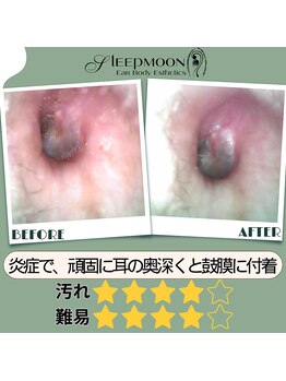 スリープムーン(Sleep MOON)/