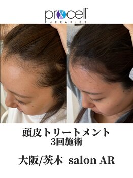 サロン アール(salon AR)/プロセルセラピーズ