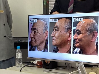 赤坂リラクゼーションナラ(NARA)の写真/首、肩を改善、韓國化粧品の驚き