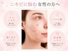 ニキビケア/肌荒改善【水光プラズマ】雑菌を滅菌!プツプツ凸凹お悩み肌に◎