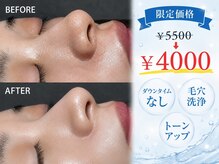 オンフリーク(ON FLEEK)