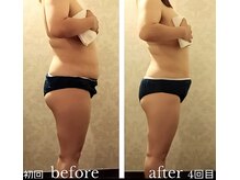 バービーホリック(barbie holic)/１３０分コース　初回~4回目比較