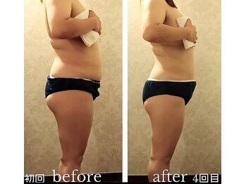 バービーホリック(barbie holic)/１３０分コース　初回~4回目比較