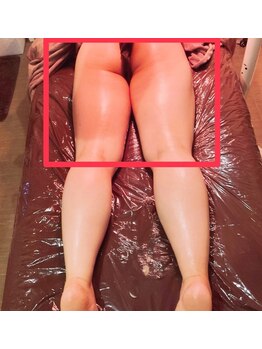 サロン リーナ 北千住店(Salon Lena)/西洋式深層強力リンパ+体質整鍼