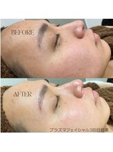 アモール 丸亀店(Amor)/眉毛/まつげパーマ/毛穴/脱毛