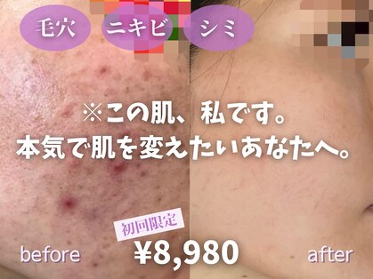 スパ ザ トルトル(SPA The toltol)の写真