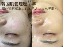 グレイスシャイン(GraceShine)の雰囲気(【韓国肌管理歴10年】毛穴/シミ/ニキビ肌質改善お任せください☆)