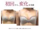 バストアップ&バストケア専門サロン CANBELLE 【キャンベル】の写真