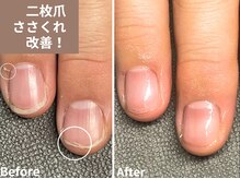 大人ネイル/ハンドケア