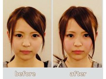 芦田整体療術院/整顔・小顔コース