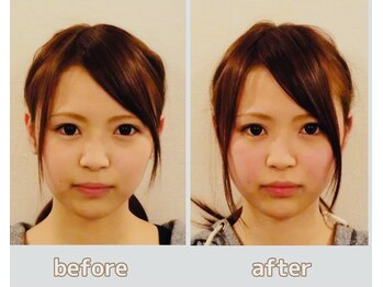 芦田整体療術院/整顔・小顔コース