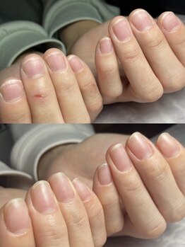 リズ ネイル(Rizu Nail)の写真/爪が小さい/弱い/コンプレックスがあり、ネイルに挑戦できなかった…等のお悩みをお持ちの方は当サロンへ♪