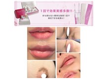 ベルシア(BELCIA)の雰囲気（唇/ボディーの黒ずみには【ローマピンク】唇の色素が薄い方も◎）