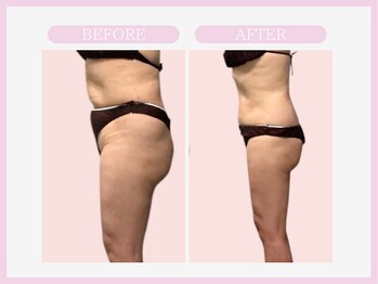 スリムライン 秋田店(The Slim Line)/before→after