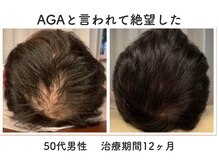 あるしあ鍼灸接骨院 木曽川院の雰囲気(むくみやたるみ改善し、徹底的に引き上げ小顔に♪)