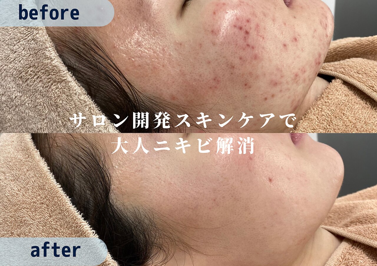 スハダビイチイチゼロ(suhadabi110)｜ホットペッパービューティー