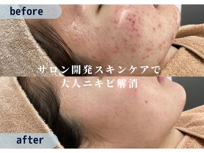 スハダビ110(suhadabi110)の写真