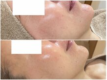 ナトラ 蔵前/50前半エイジングケア