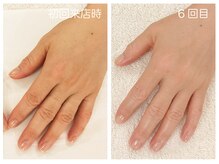 キレイテ 上野店/40代/6回目【上野ハンドケア】