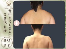 サムデイ プレミアム 池袋店(SOMEDAY PREMIUM)/BODY