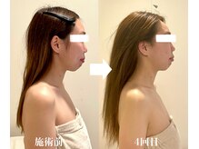 サピュイエ(S'appuyer)/姿勢改善で立ち姿も美しく◎