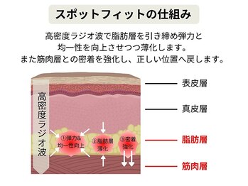 ルディラ 横浜店/スポットフィット