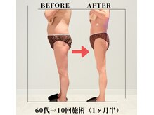 フェムビー 千葉駅前店(FEMBE)の雰囲気（【ぽっこりお腹】運動しても落ちない頑固な脂肪もしっかり分解◎）