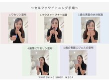 ホワイトニングショップ 池田店/【施術　セルフ】