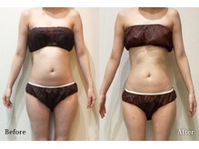 アネル 宮古島店(anel)/