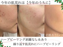 マシェリ 吉祥寺(Macherie)