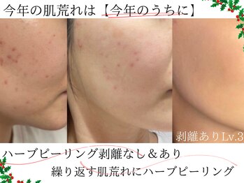 マシェリ 吉祥寺(Macherie)