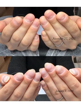 リミズネイルビューティー 名駅店(RimisNailxbeauty)/一番人気 深爪から自然な自爪へ