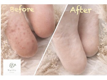 乾燥対策【SpaLuce】角質ケア